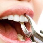 Dental Bone Loss Treatment