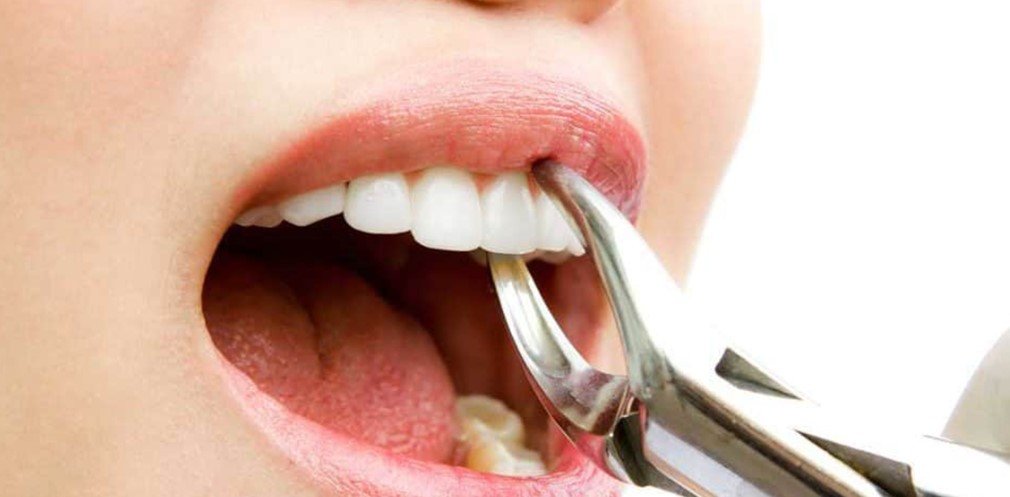 Dental Bone Loss Treatment