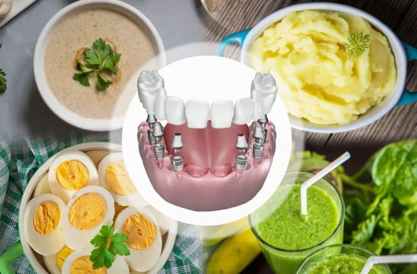 Diet and Nutrition after oral surgery