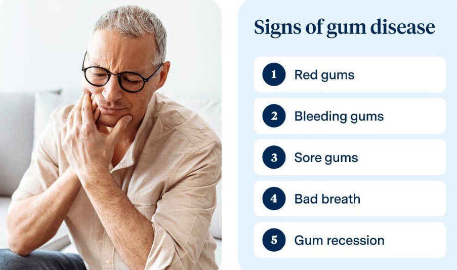Signs of Gum Disease from Dipping