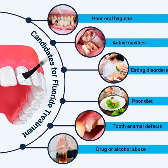 What Fluoride Treatment Does